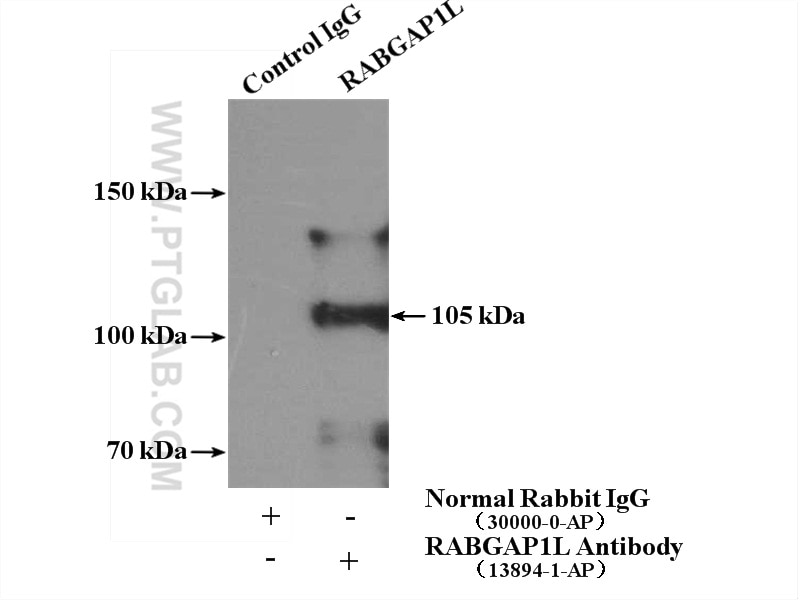 Immunoprecipitation (IP) experiment of HeLa cells using RABGAP1L Polyclonal antibody (13894-1-AP)