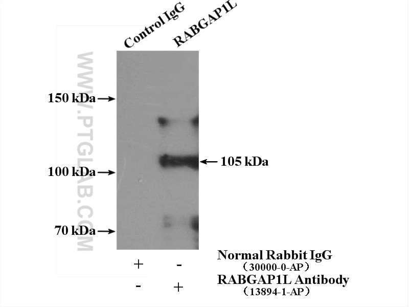 IP experiment of HeLa using 13894-1-AP