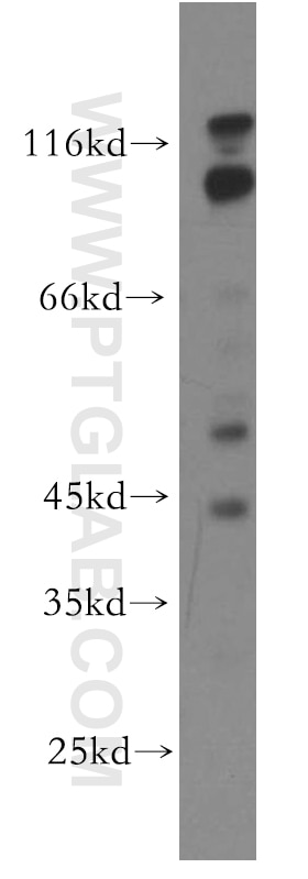 Western Blot (WB) analysis of MCF-7 cells using RABGAP1L Polyclonal antibody (13894-1-AP)