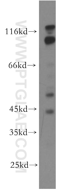 WB analysis of MCF-7 using 13894-1-AP