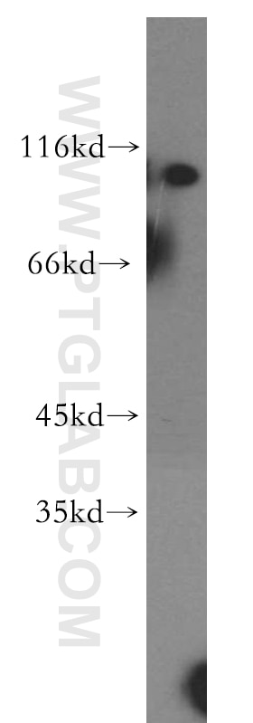 Western Blot (WB) analysis of HeLa cells using RABGAP1L Polyclonal antibody (13894-1-AP)