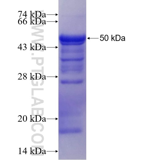 RABGAP1L fusion protein Ag5305 SDS-PAGE