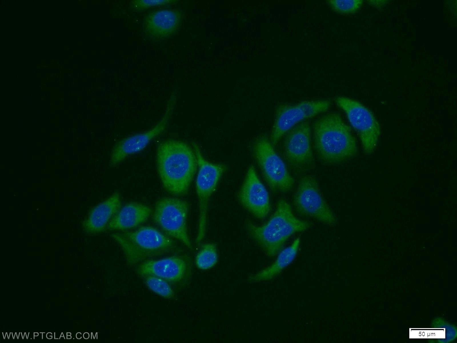 Immunofluorescence (IF) / fluorescent staining of PC-3 cells using RabGEF1 Polyclonal antibody (12735-1-AP)