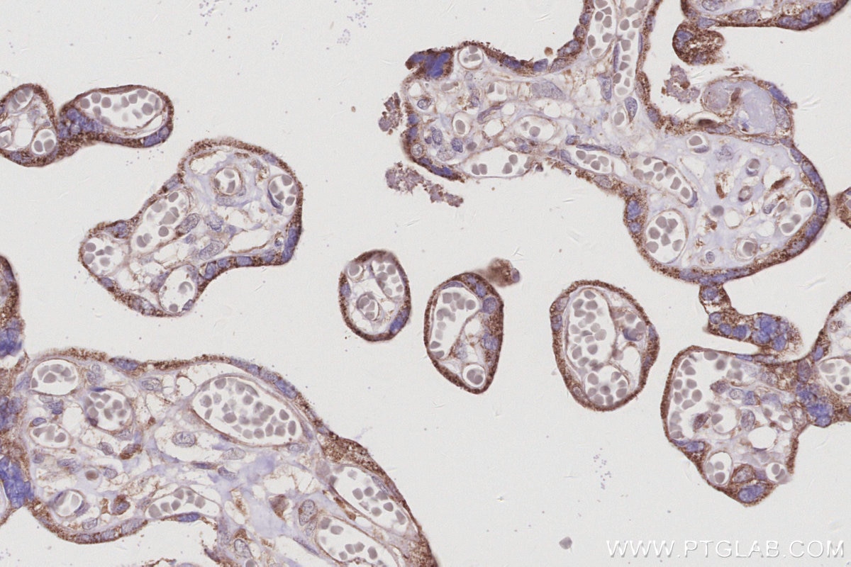 Immunohistochemistry (IHC) staining of human placenta tissue using RabGEF1 Polyclonal antibody (12735-1-AP)
