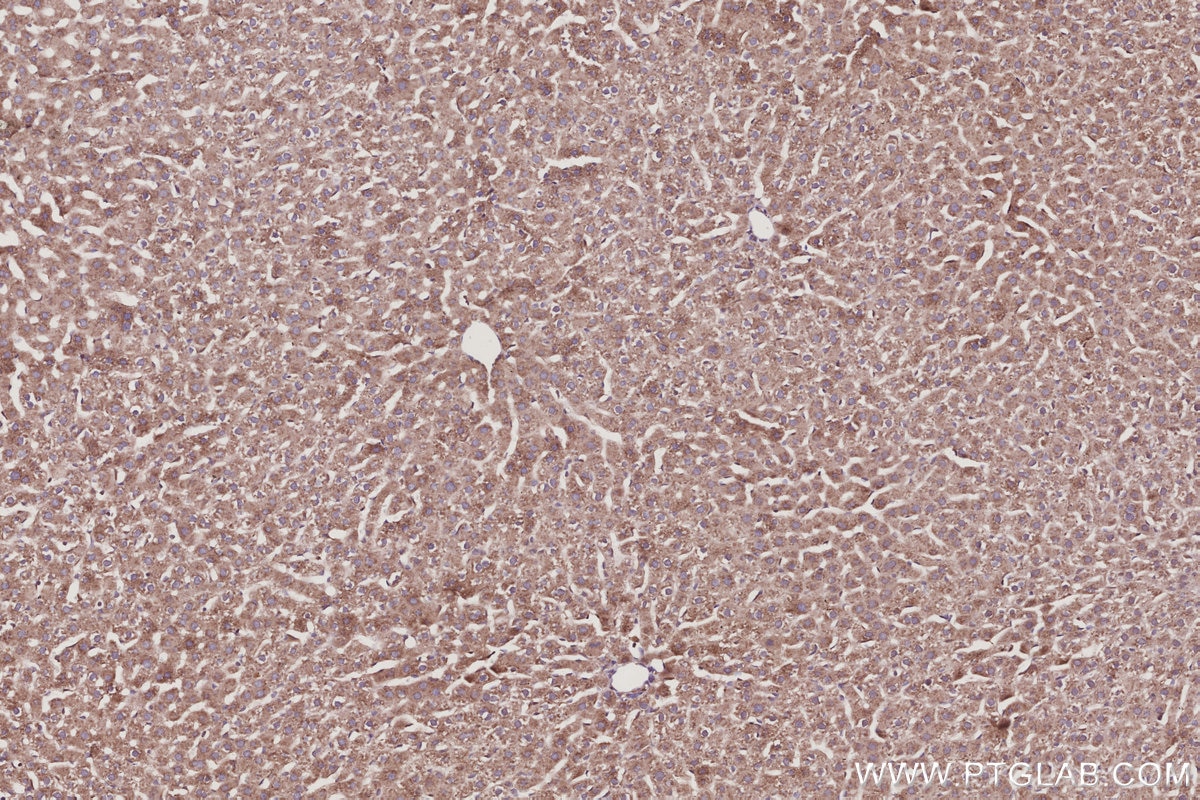 Immunohistochemistry (IHC) staining of rat liver tissue using RabGEF1 Polyclonal antibody (12735-1-AP)
