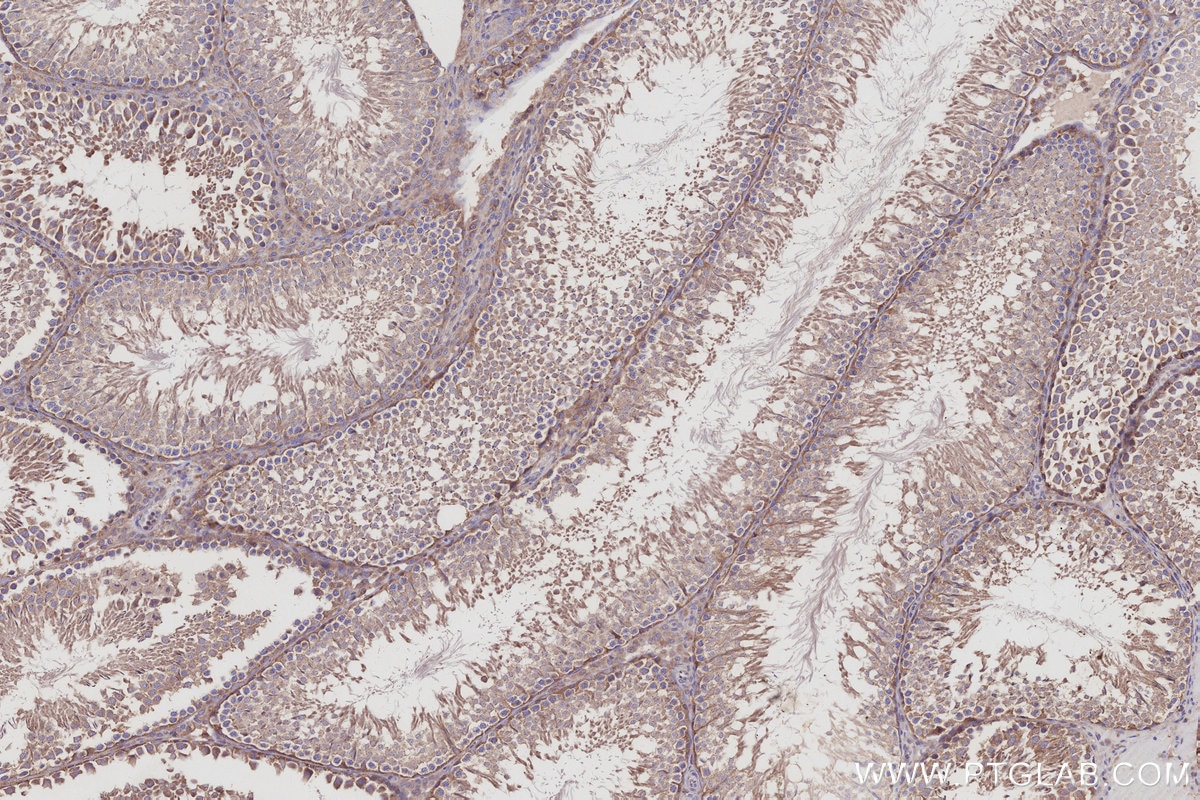 Immunohistochemistry (IHC) staining of rat testis tissue using RabGEF1 Polyclonal antibody (12735-1-AP)