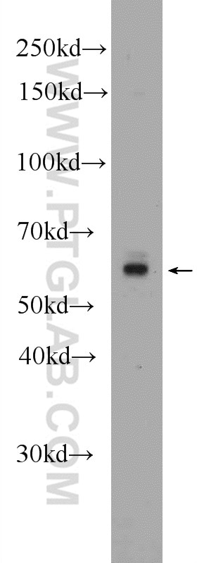 Western Blot (WB) analysis of PC-3 cells using RabGEF1 Polyclonal antibody (12735-1-AP)