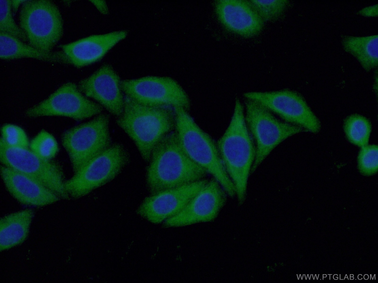 Immunofluorescence (IF) / fluorescent staining of HepG2 cells using RABGGTA Polyclonal antibody (14448-1-AP)