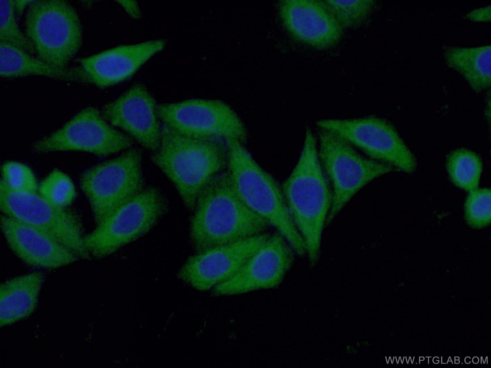 IF Staining of HepG2 using 14448-1-AP