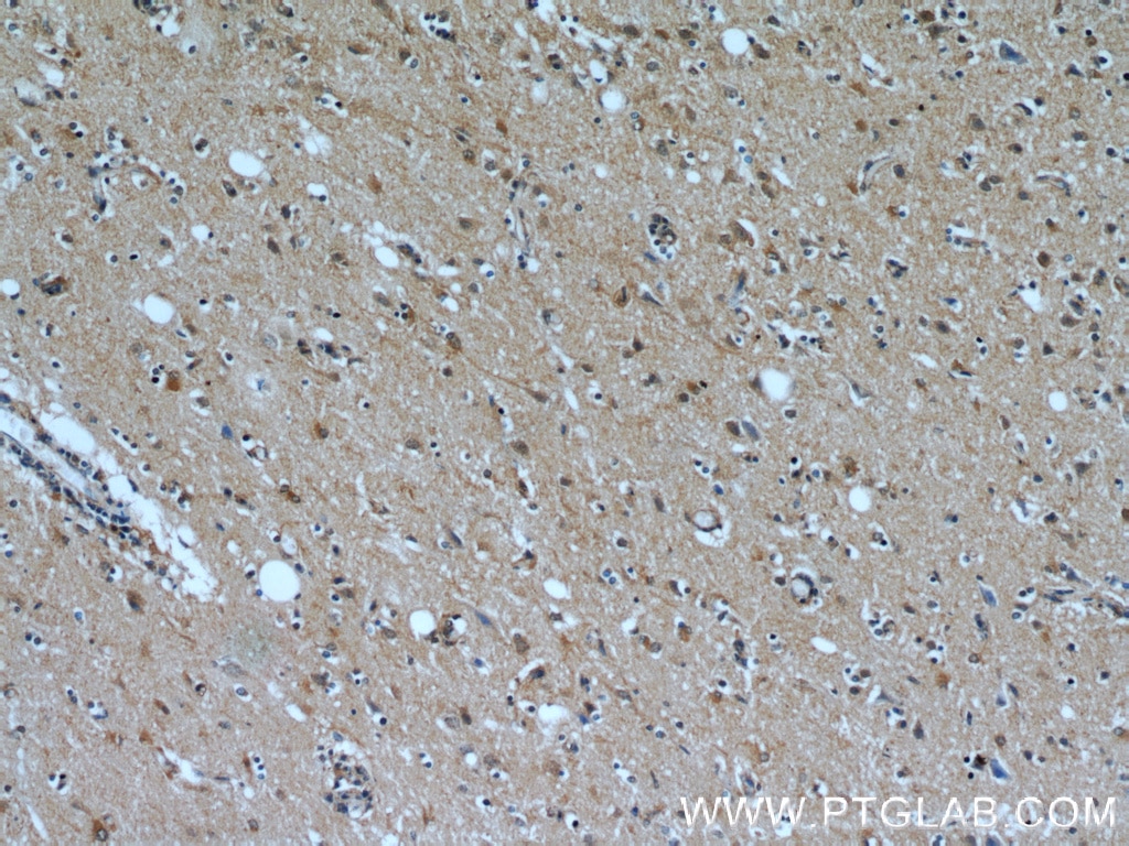 Immunohistochemistry (IHC) staining of human brain tissue using RABGGTA Polyclonal antibody (14448-1-AP)