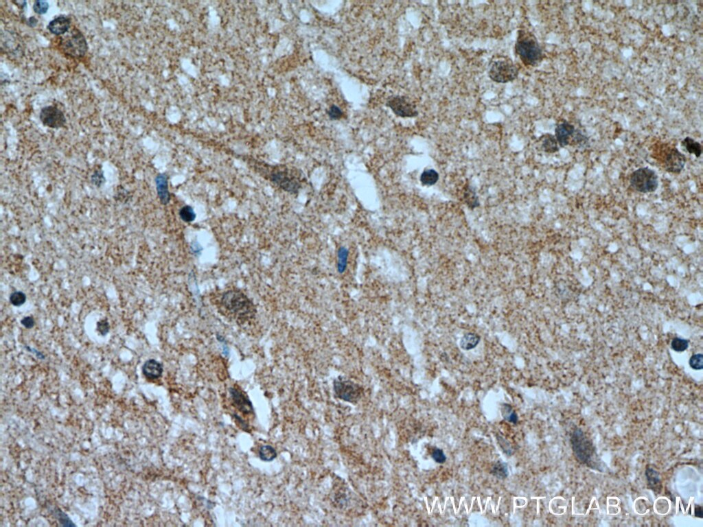 Immunohistochemistry (IHC) staining of human brain tissue using RABGGTA Polyclonal antibody (14448-1-AP)