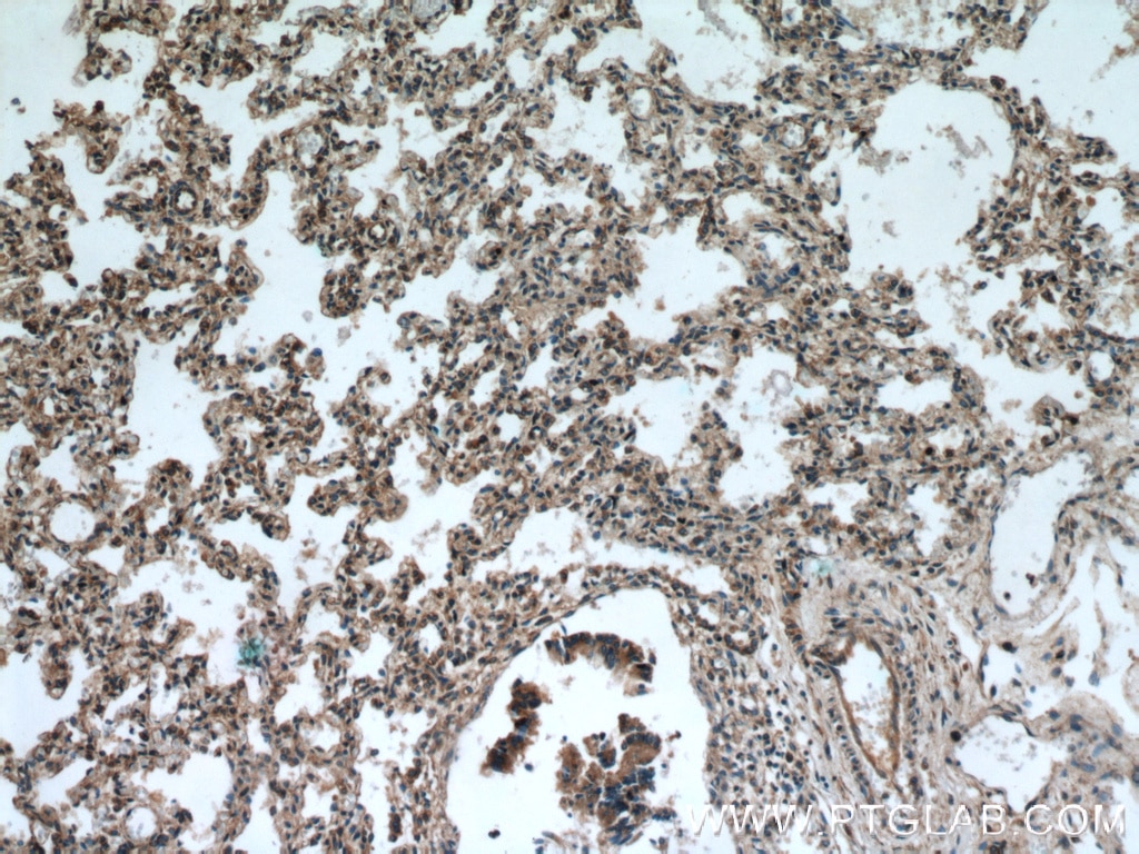 IHC staining of human lung using 14448-1-AP