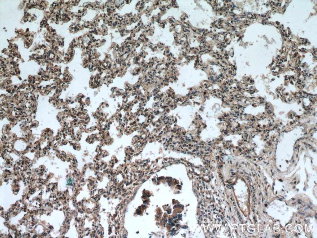 Immunohistochemistry (IHC) staining of human lung tissue using RABGGTA Polyclonal antibody (14448-1-AP)