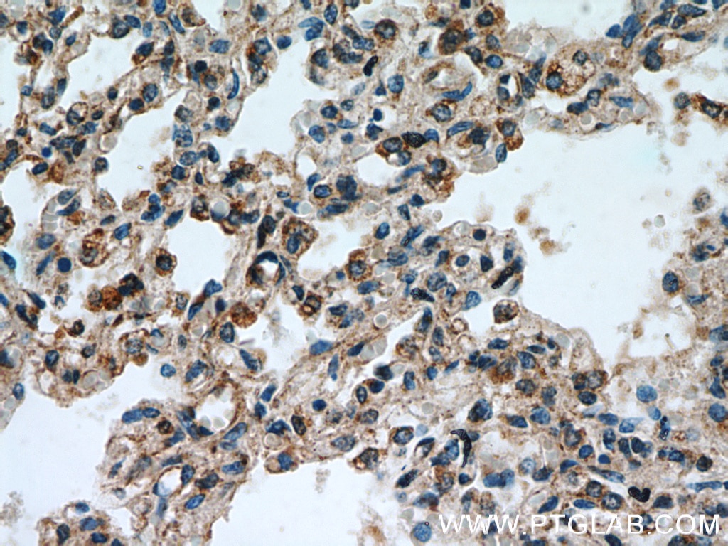 Immunohistochemistry (IHC) staining of human lung tissue using RABGGTA Polyclonal antibody (14448-1-AP)