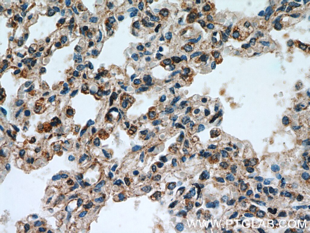 IHC staining of human lung using 14448-1-AP