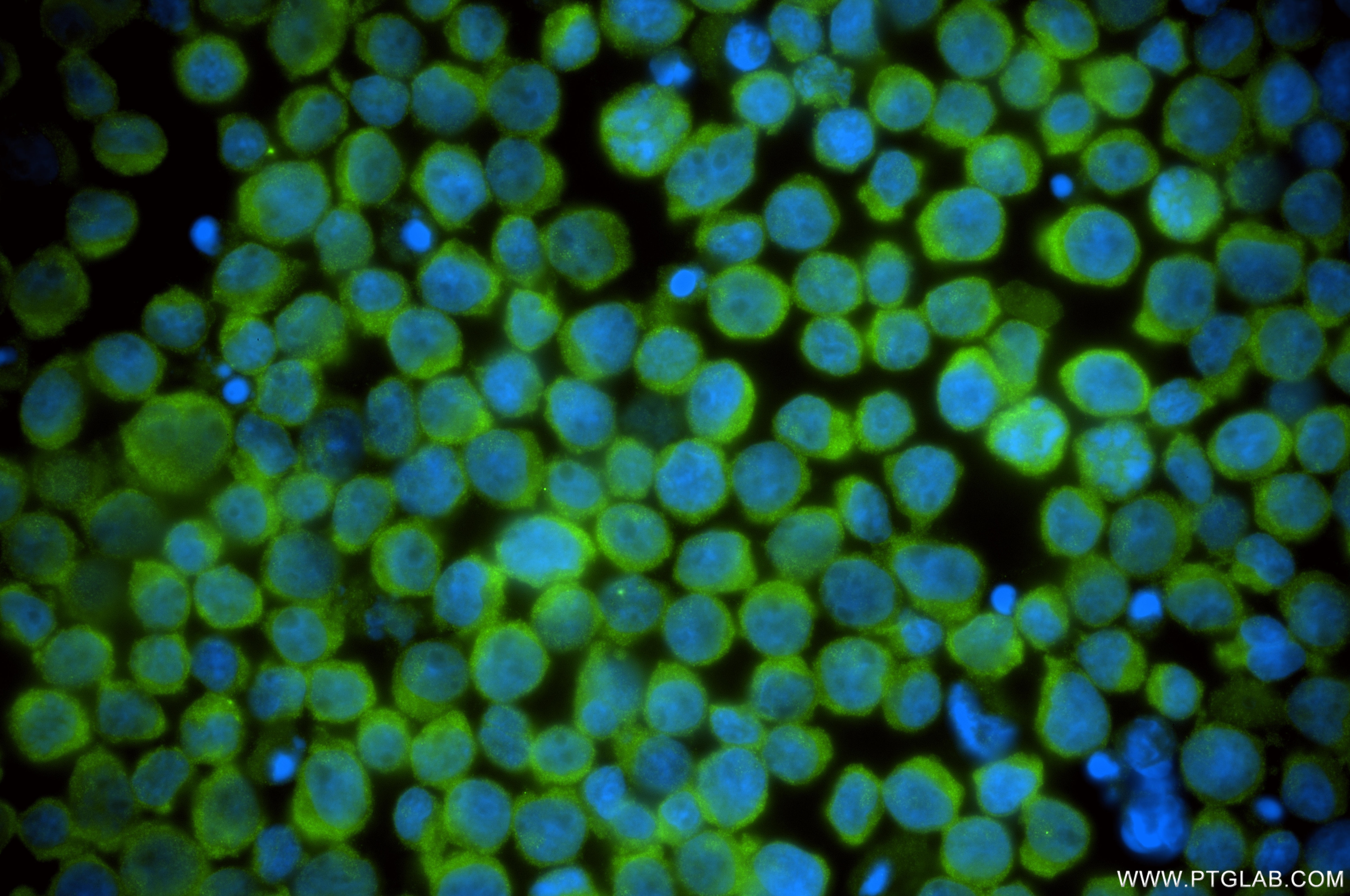 Immunofluorescence (IF) / fluorescent staining of Jurkat cells using RABGGTA Recombinant monoclonal antibody (86386-3-RR)