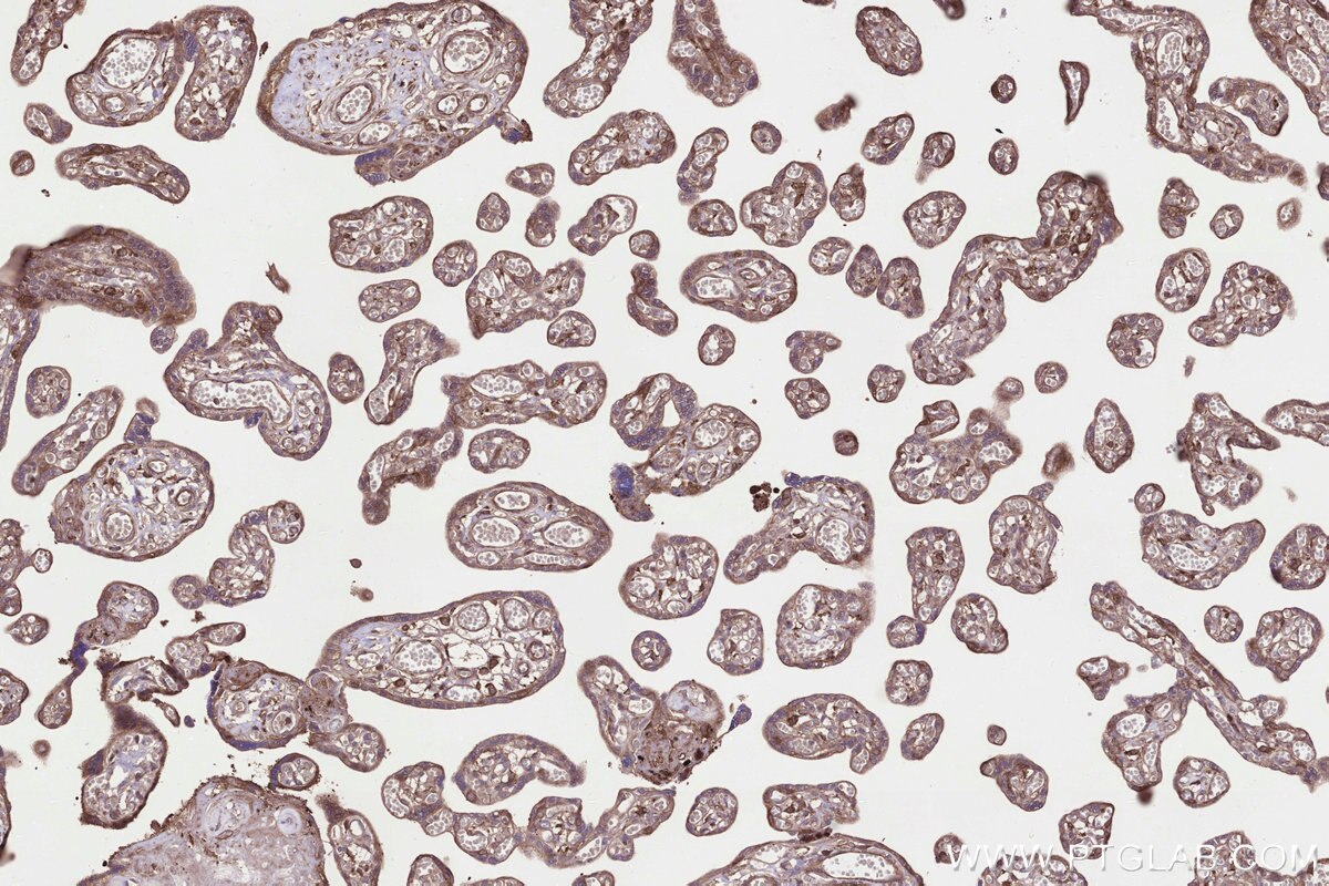 Immunohistochemistry (IHC) staining of human placenta tissue using RABGGTA Recombinant monoclonal antibody (86386-3-RR)