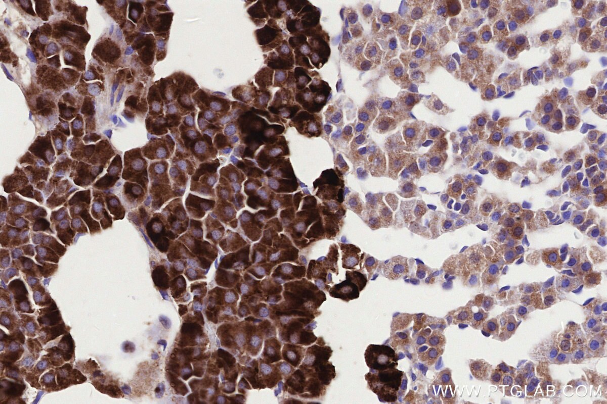 Immunohistochemistry (IHC) staining of rat adrenal gland tissue using RABGGTA Recombinant monoclonal antibody (86386-3-RR)