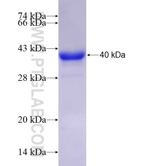 RABGGTB fusion protein Ag28702 SDS-PAGE
