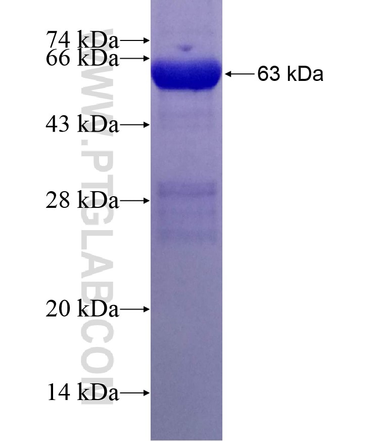 RABGGTB fusion protein Ag2376 SDS-PAGE