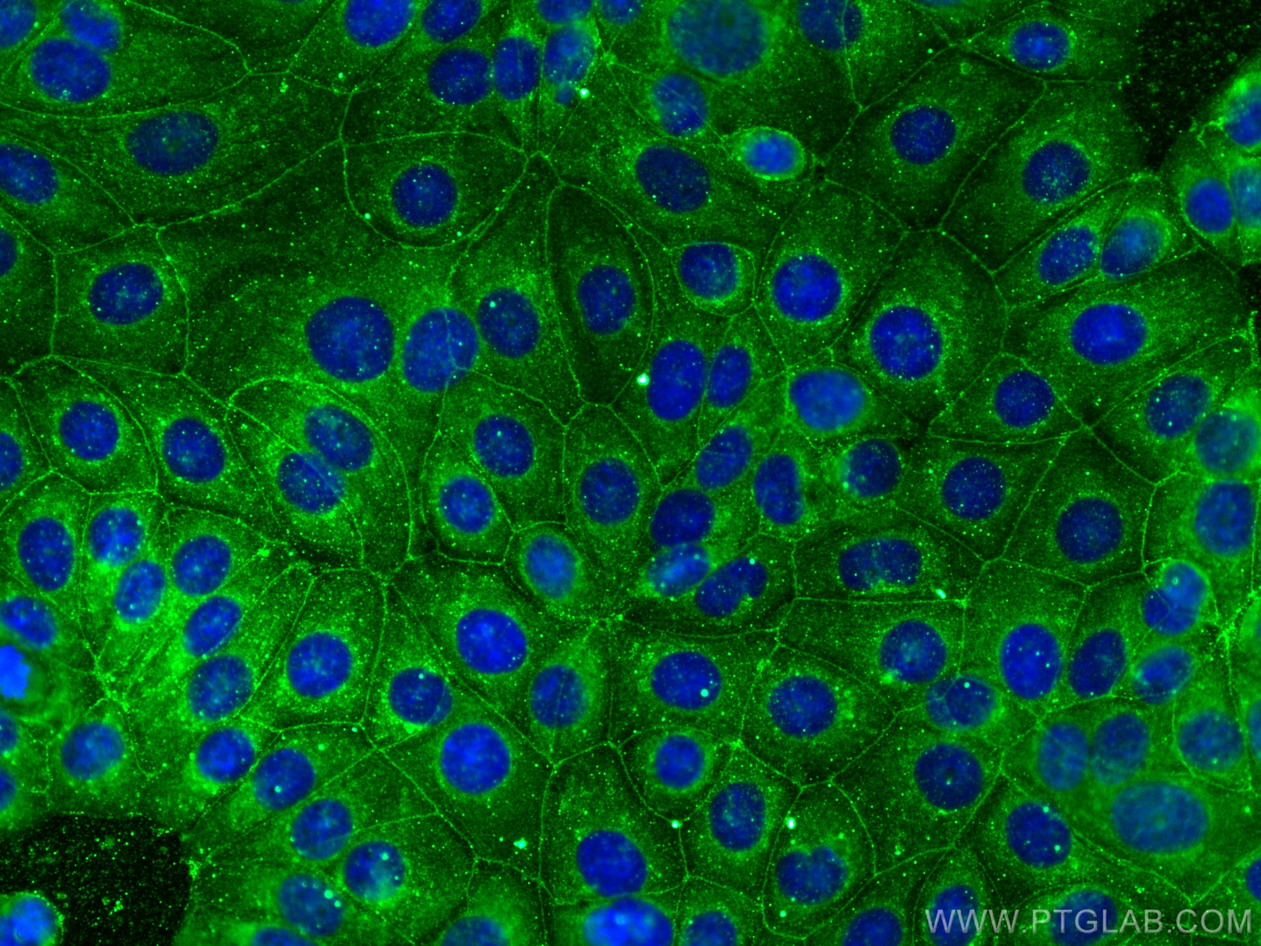 Immunofluorescence (IF) / fluorescent staining of MCF-7 cells using RABIF Polyclonal antibody (29113-1-AP)