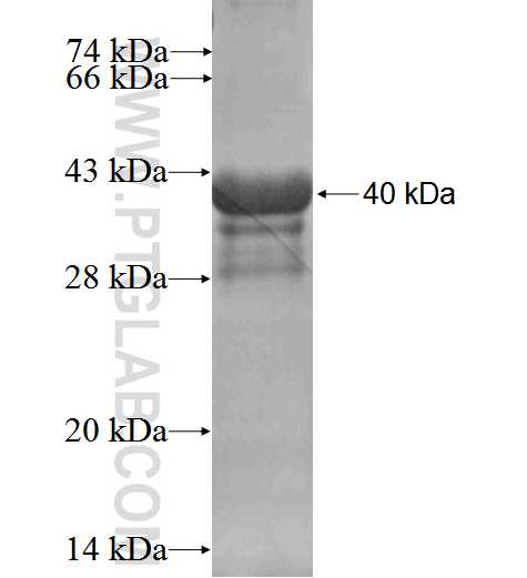 RABIF fusion protein Ag3236 SDS-PAGE