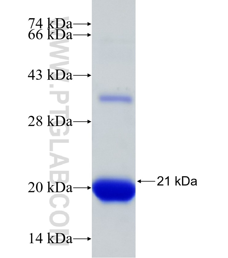 RABIN8 fusion protein Ag31301 SDS-PAGE RABIN8 fusion protein Ag31301 SDS-PAGE