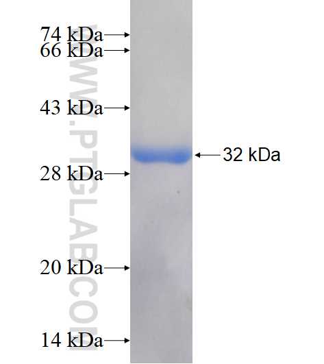 RABIN8 fusion protein Ag17865 SDS-PAGE