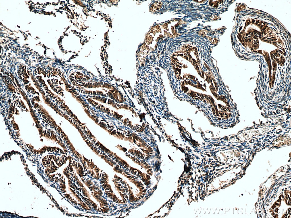 Immunohistochemistry (IHC) staining of mouse ovary tissue using RABL2A Polyclonal antibody (17816-1-AP)