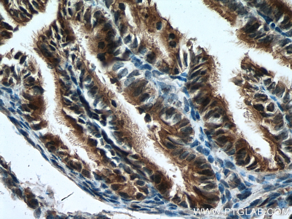 Immunohistochemistry (IHC) staining of mouse ovary tissue using RABL2A Polyclonal antibody (17816-1-AP)