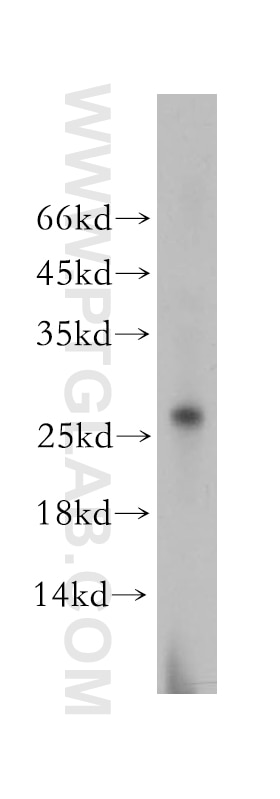 Western Blot (WB) analysis of human brain tissue using RABL2A Polyclonal antibody (17816-1-AP)