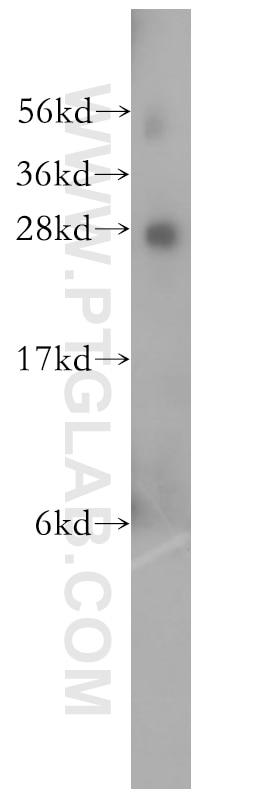 Western Blot (WB) analysis of human brain tissue using RABL2B Polyclonal antibody (11588-1-AP)