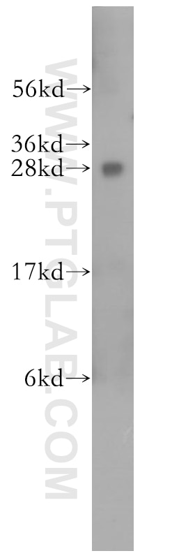 Western Blot (WB) analysis of human kidney tissue using RABL2B Polyclonal antibody (11588-1-AP)