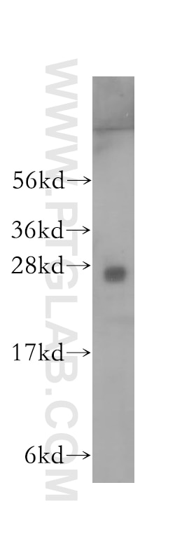 Western Blot (WB) analysis of human liver tissue using RABL2B Polyclonal antibody (11588-1-AP)