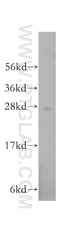 Western Blot (WB) analysis of human heart tissue using RABL2B Polyclonal antibody (11588-1-AP)