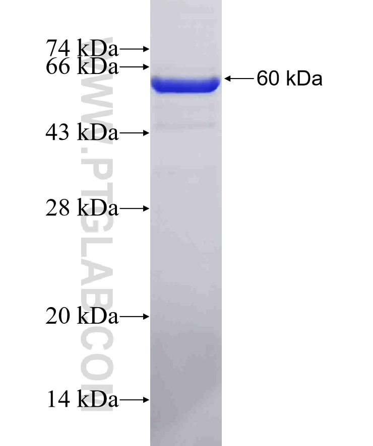 RABL2B fusion protein Ag2189 SDS-PAGE