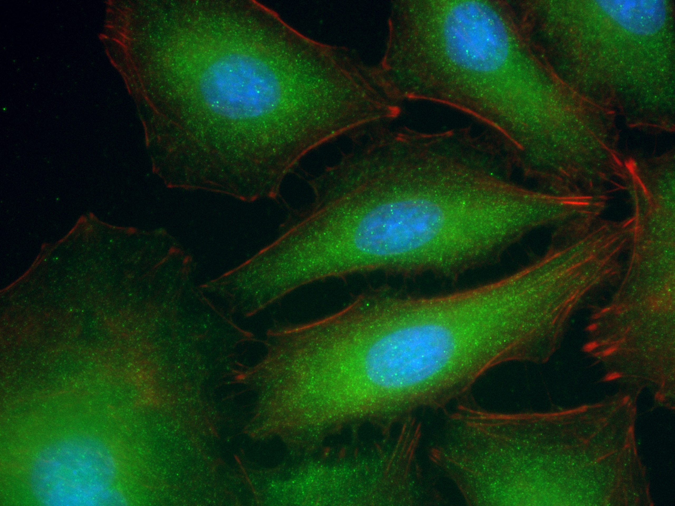 Immunofluorescence (IF) / fluorescent staining of A549 cells using RABL3 Polyclonal antibody (11916-1-AP)