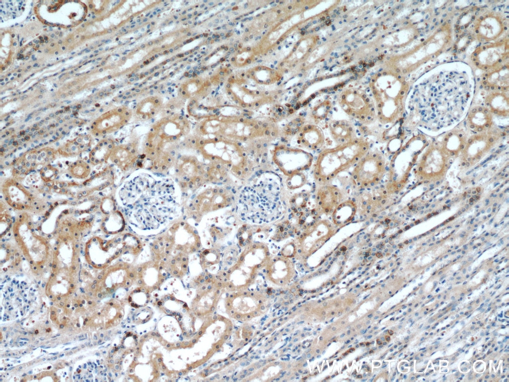 Immunohistochemistry (IHC) staining of human kidney tissue using RABL3 Polyclonal antibody (11916-1-AP)