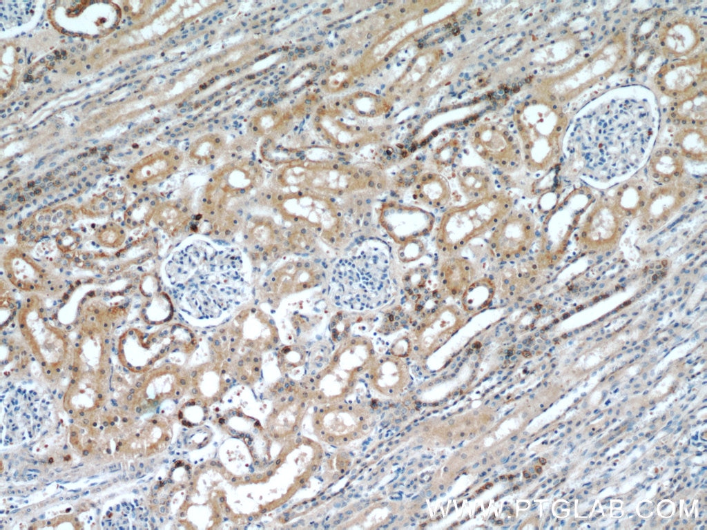 Immunohistochemistry (IHC) staining of human kidney tissue using RABL3 Polyclonal antibody (11916-1-AP)