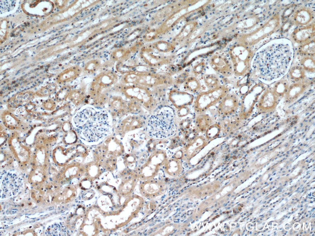 IHC staining of human kidney using 11916-1-AP