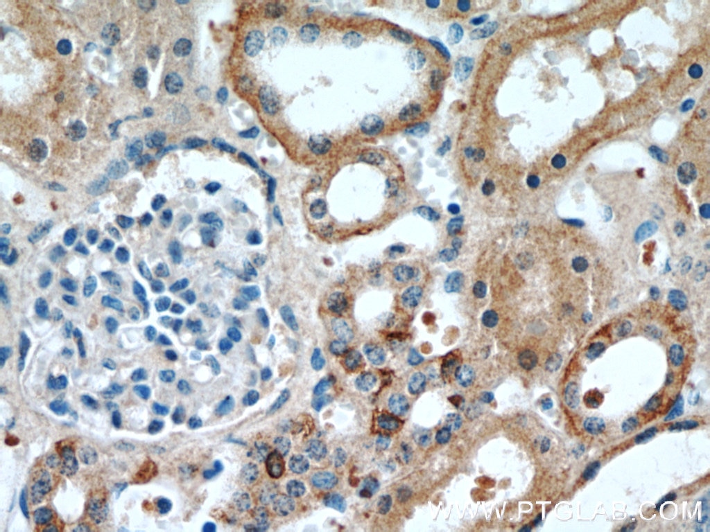 Immunohistochemistry (IHC) staining of human kidney tissue using RABL3 Polyclonal antibody (11916-1-AP)