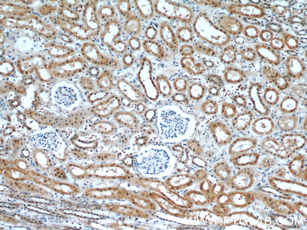 Immunohistochemistry (IHC) staining of human kidney tissue using RABL3 Polyclonal antibody (11916-1-AP)