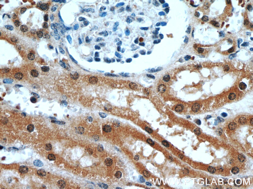 Immunohistochemistry (IHC) staining of human kidney tissue using RABL3 Polyclonal antibody (11916-1-AP)