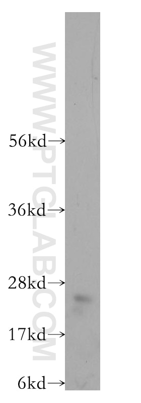 Western Blot (WB) analysis of human brain tissue using RABL3 Polyclonal antibody (11916-1-AP)