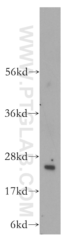 Western Blot (WB) analysis of human lung tissue using RABL3 Polyclonal antibody (11916-1-AP)