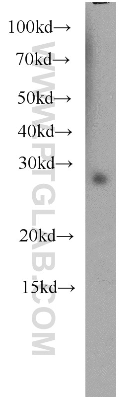 Western Blot (WB) analysis of mouse brain tissue using RABL3 Polyclonal antibody (11916-1-AP)