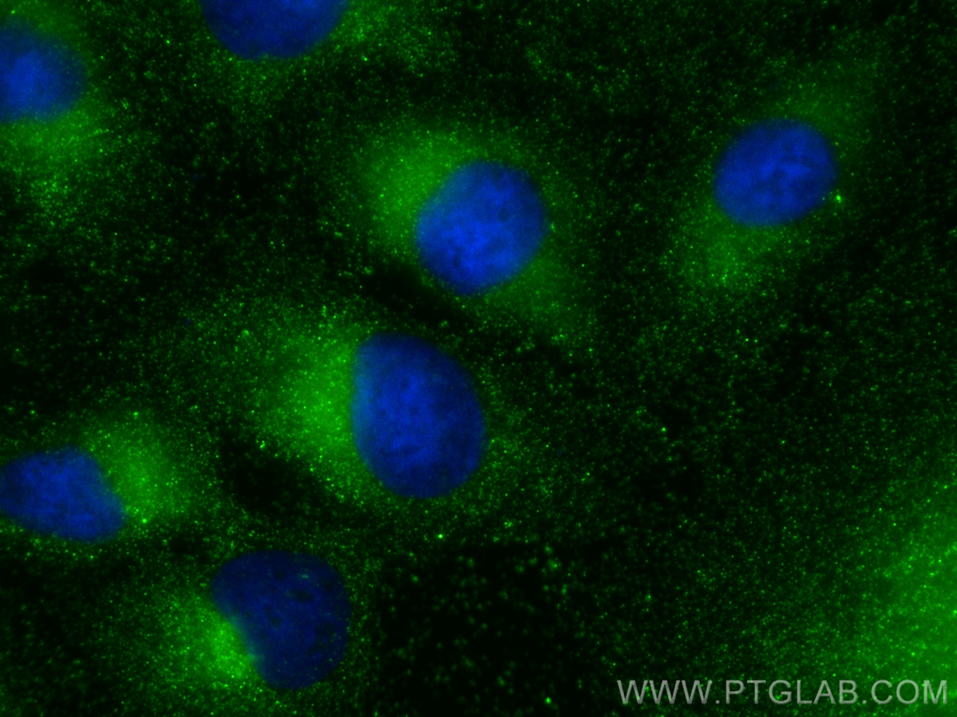 Immunofluorescence (IF) / fluorescent staining of A549 cells using RABL3 Monoclonal antibody (68342-1-Ig)