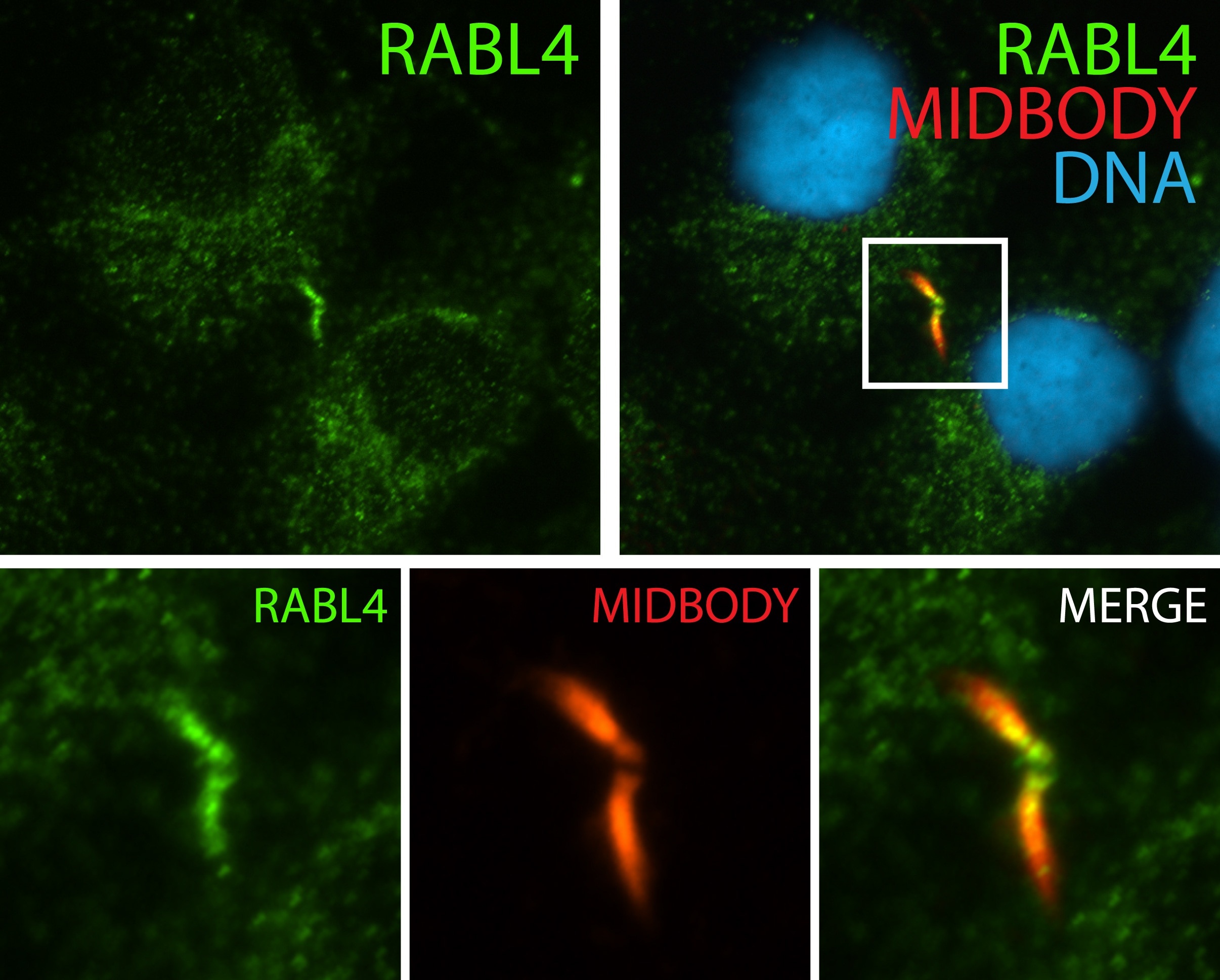 Immunofluorescence (IF) / fluorescent staining of hTERT-RPE1 cells using IFT27 Polyclonal antibody (15017-1-AP)