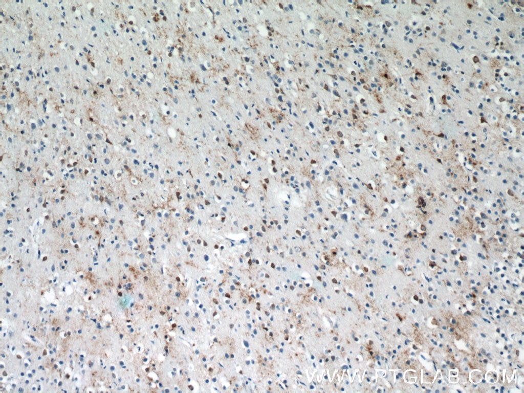 Immunohistochemistry (IHC) staining of human brain tissue using IFT27 Polyclonal antibody (15017-1-AP)