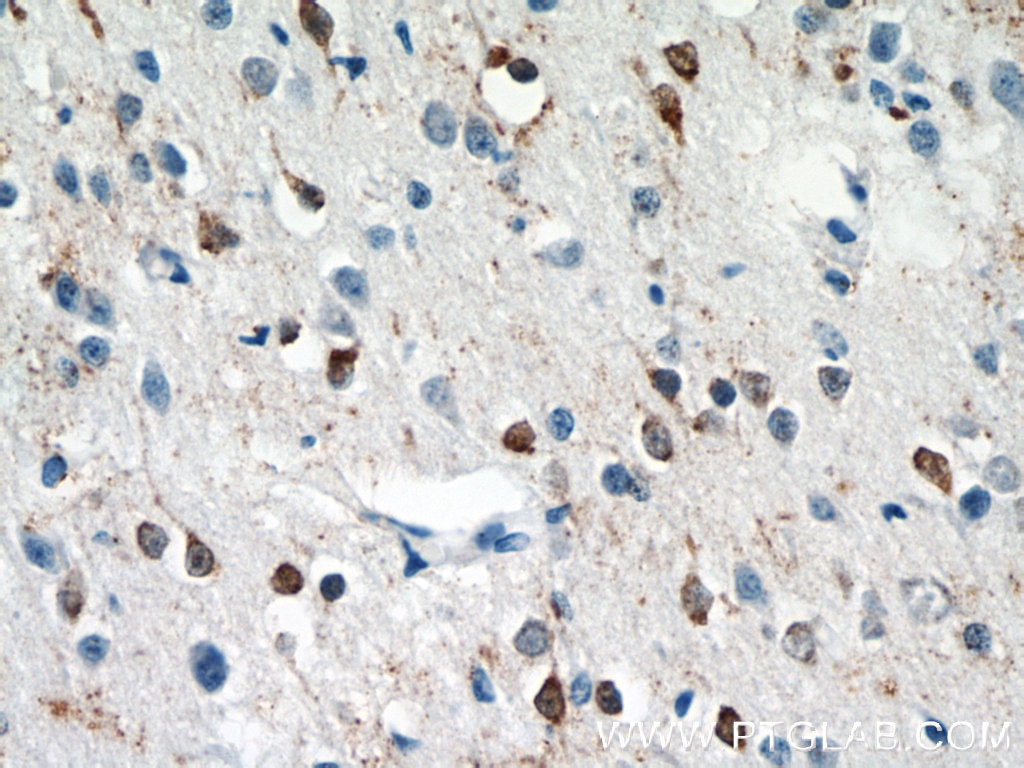 Immunohistochemistry (IHC) staining of human brain tissue using IFT27 Polyclonal antibody (15017-1-AP)